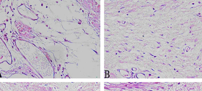 Yaraları Hiçbir İz Bırakmadan İyileştirebiliyoruz